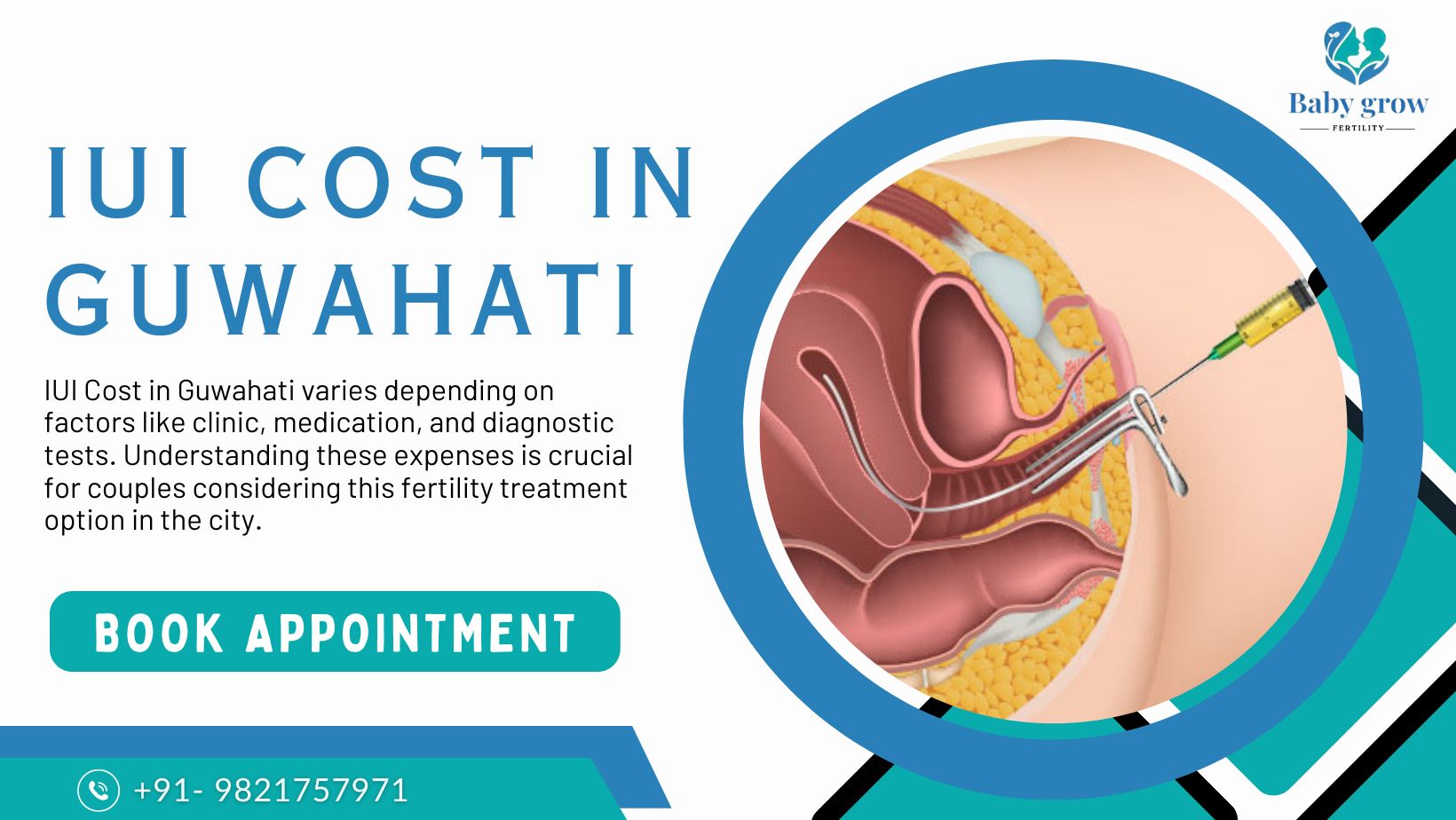 IUI Cost in Guwahati IUI Cost in Guwahati