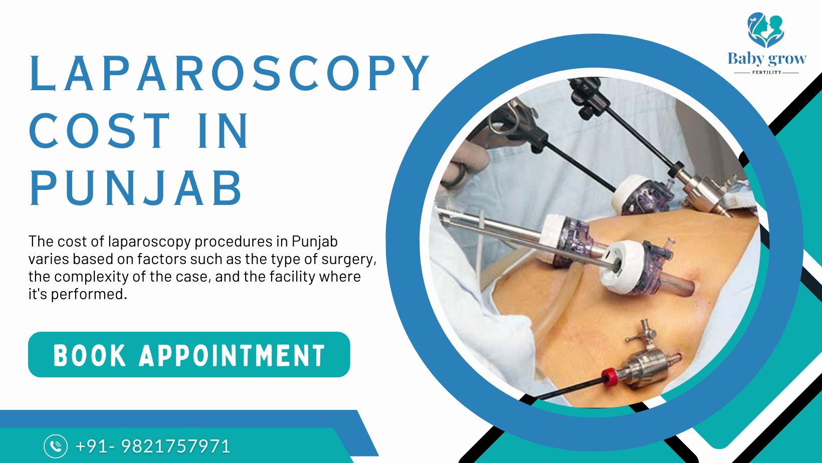 Laparoscopy Cost in Punjab Laparoscopy Cost in Punjab